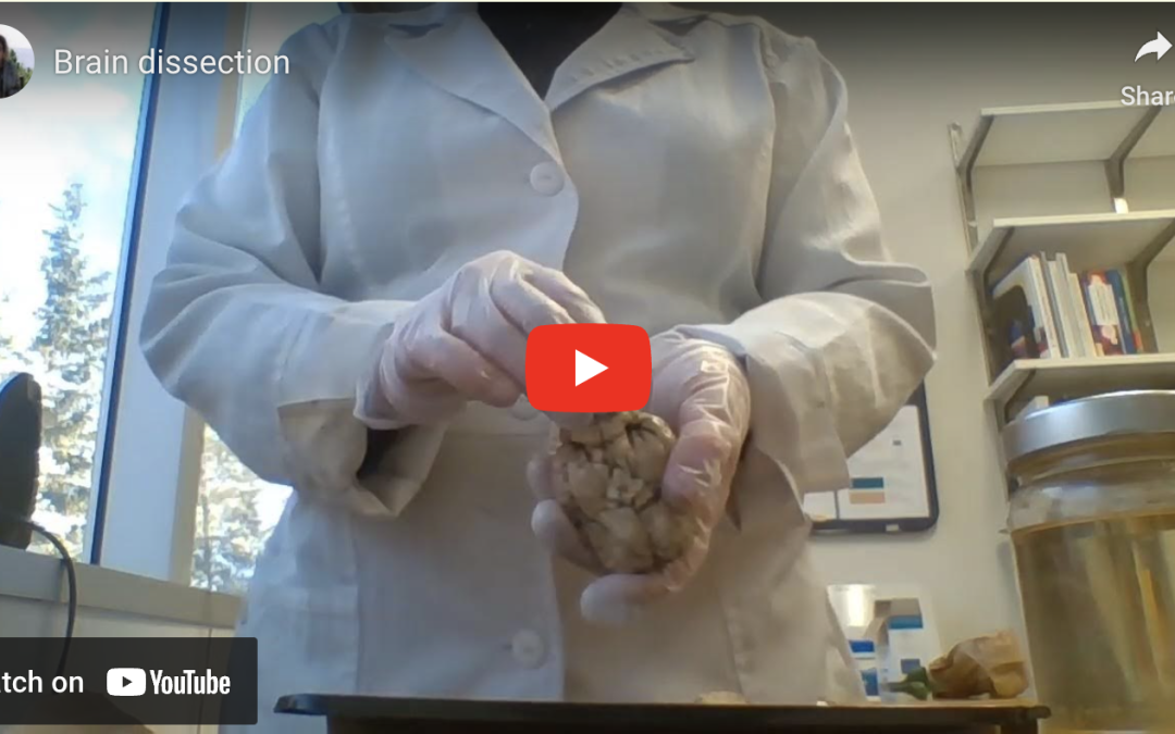 Brain Dissection